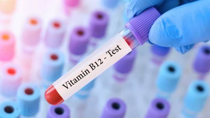 6 Questions About Vitamin B12 Testing in the UK